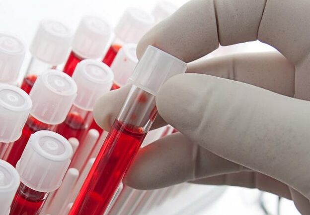 Blutt Test nom Alkohol drénken